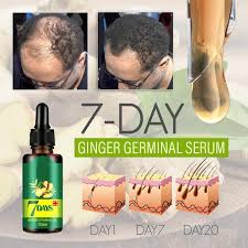 Starting from repairing your damaged hair to stimulating your hair follicles, vedix hair growth serum leaves no stone unturned to boost your hair's health. 7 Day Ginger Germinal Serum Hair Regrowth Hair Loss Hair Loss Remedies
