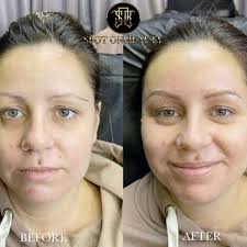 Spot On Health & Beauty