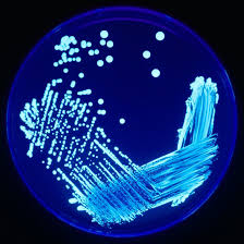 Vous avez des travaux à réaliser chez vous ? Legionella Wikipedia