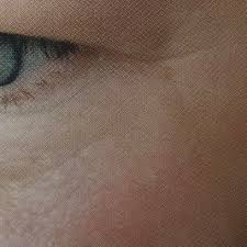 Lucy peters aesthetic center is under the expert medical direction of r. Lucy Peters Aesthetic Center Home Facebook