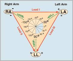 Ecg theory leads einthoven wilsons central terminal placement. Ecg Learning Center An Introduction To Clinical Electrocardiography