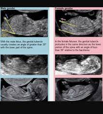 Several places were found that match your search criteria. Pin On Medicina Fetal