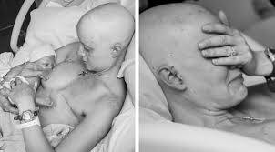 Fortunately, chemotherapy is still an effective option. Mom Diagnosed With Breast Cancer During Pregnancy Delivers Miracle Baby The Photos Say It All