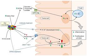A persistent and unexplained change in bowel. Cancers Free Full Text The Role Of The Gut Microbiome In Colorectal Cancer Development And Therapy Response Html