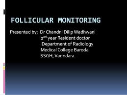 Follicular Monitoring