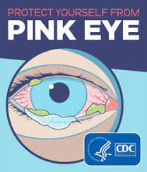 Preventing Pink Eye (Conjunctivitis) | Cdc