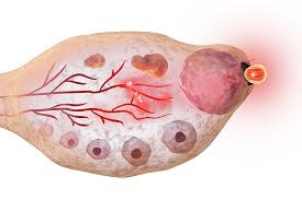 Matokeo ya picha ya image of follicles releasing an egg