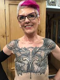Image result for Mastectomy