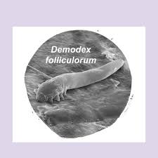 Image result for Demodex folliculorum