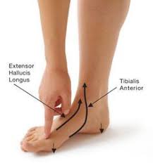 How to stop bunion pain. Pin On Fitness