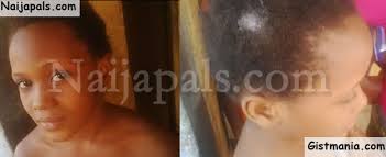 PHOTOS: NGO Rescues 9 Year Old Onyinyechi From Aunt Who Turned Her To Slave  In Lagos