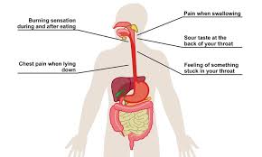 How low stomach acid hurts you: Can Stress Cause Stomach Problems Health Plus