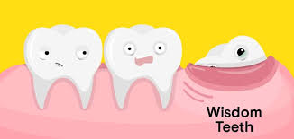 Unlike all your other teeth, which start to emerge around the age of six, wisdom teeth don't appear until later in life, usually between the ages of 17 and 25. How To Cope With Pain From Erupting Wisdom Teeth Waltham Ma