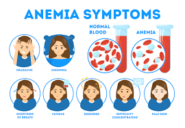 Image result for Anemia