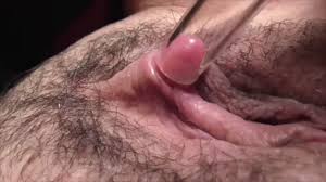 진동하는 진공관으로 음핵 자극