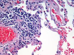 There are four basic types of tissue in the body of all animals, including the human body. Tissue Biology Wikipedia