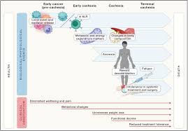 Image result for Cachexia in Cancer