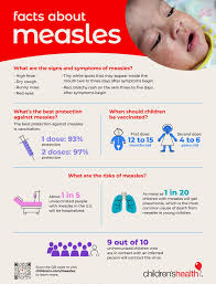 Image result for measles