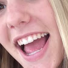 BERNARD CHANG DDS MS