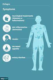 What Is Pellagra?