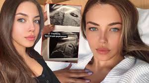 Beykent üniversitesi tv haberciliği ve programcılığı bölümünde okudu. Aygun Aydin Hamile Mi Ultrason Goruntusunu Paylasti Magazin Haberleri Milliyet