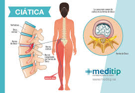 Dolor De Pierna Causas Enfermedades Relacionadas Y Tratamiento
