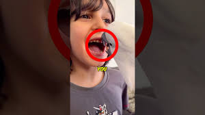 Parrot Extract Teeth😳 #shorts