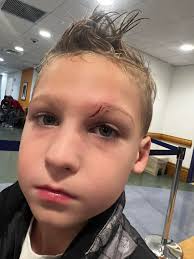 Witnessing true grit and determination