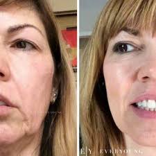 Browse the best deals on laser hair removal in the city. Top 10 Best Laser Hair Removal Near Metrotown Vancouver Bc Last Updated August 2021 Yelp