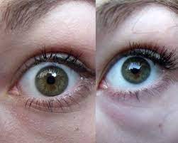 How Can You Lighten Eye Color Explore In The Post Ways On How To Lighten Your Eye Pigmentation Fast Permanen Eye Color Change Change Your Eye Color Eye Color