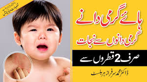 Totkay garmi dano ka ilaj. Garmi Dano Ka Ilaj In Urdu Garmi Dane Khatam Karne Ka Tarika Homeopathic Youtube