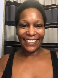 Removable denture experience and adhesive recommendations