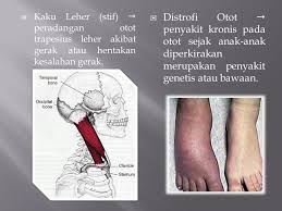 We did not find results for: Tulang Kaki Sakit Ngilu Harga Ulasan Bahan Komposisi