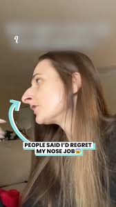She spent over $10,000 to have a perfect nose 😍