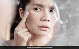 Image result