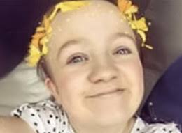 Expert Team: Acrodysostosis Support and Research