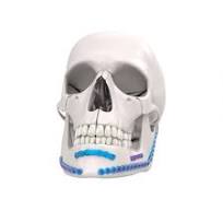 Mandible Fixation System,Medical Device Manufacturers ...