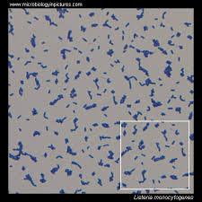 Listeria monocytogenes gram stain west nile encephalitis creutzfeldt jakob disease haemophilus influenzae type b oral polio vaccine. Listeria Microscopy Listeria Gram Stain And Cell Morphology Listeria Micrograph Appearance Under The Microscope Listeria Cell Morphology Microscopic Picture Of Listeria