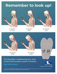 Forward Head Posture And Neck Pain Cervical Kyphosis Foot Levelers