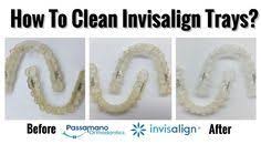 How To Clean A Crusty Invisalign Tray Or Retainer At Home How To Clean Invisalign Invisalign How To Clean Retainers