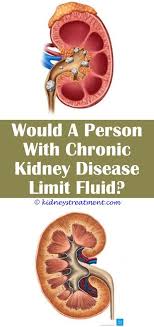 Kidney Disease Diet Products Kidney Disease Symptoms Kidney Disease Chronic Kidney Disease