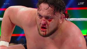 The long sound is marked by a line above the vowel, called a macron (or fa'amamafa). Samoa Joe Injured During Wwe Commercial Shoot