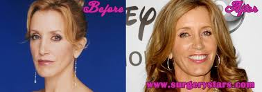 Then came arguably grey's biggest career mistake: Felicity Huffman Plastic Surgery Pictures