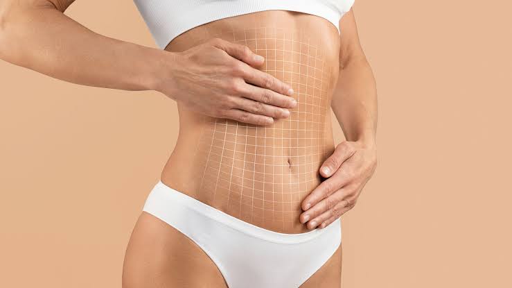 8 Things I Wish I Knew Before My Tummy Tuck in guadalajara &ndash; Dr. Rafael  Arenas Plastic Surgery