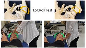 Image result for Log Roll Test