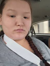 Crochet after tfcc tear surgery