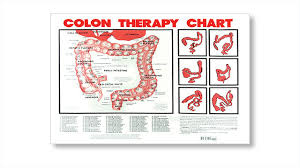 Colon Hydrotherapy Medical Charts