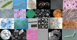 Pond water under microscope labeled. How These 26 Things Look Like Under The Microscope With Diagrams