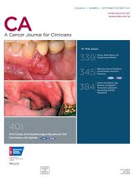 Image result for spinocellular carcinoma of the oral cavity