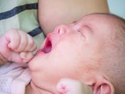 Other signs of a food allergy may include: Breastfeeding A Baby With Allergies